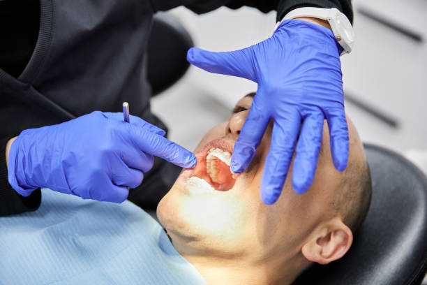 Best Broken Tooth Emergency  in Lexington, MN